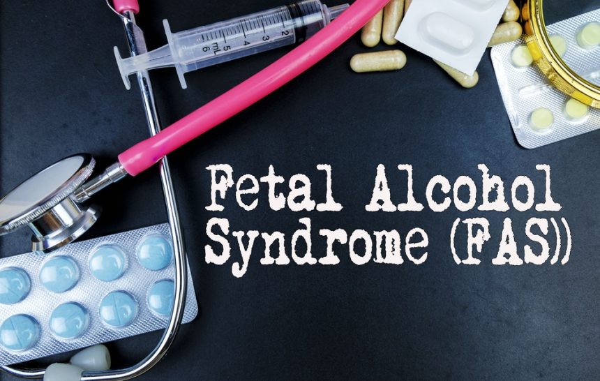 Detoks Fenix, FAS Czym jest zespół FAS?